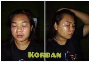 Dugaan Tindak Pidana Penganiayaan di Wilkum Polsek Jawai Selatan Polres Sambas