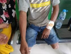 Nyaris Tewas! Buruh Bangunan Berhasil Lepas dari Cengkraman Mulut Buaya Muara